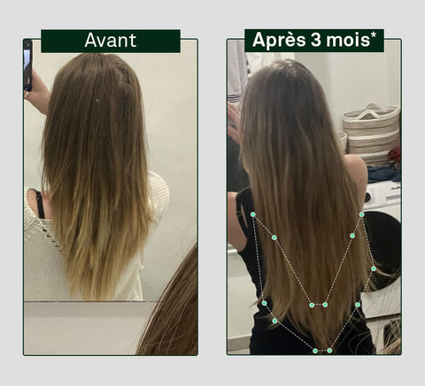 Pirms un pēc matu augšanas salīdzinājums uz cilvēka galvas, parādot redzamu atšķirību pēc 3 mēnešiem.