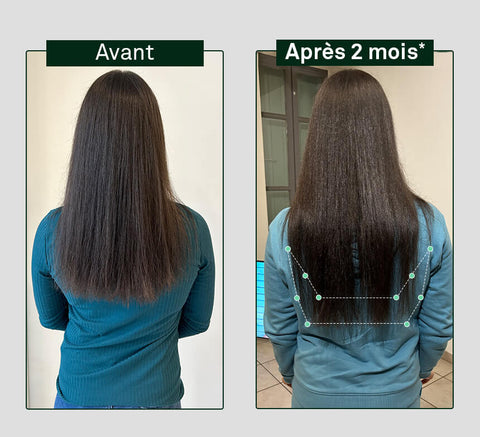 Pirms un pēc matu augšanas salīdzinājums uz personas galvas, parādot redzamu atšķirību pēc 2 mēnešiem.