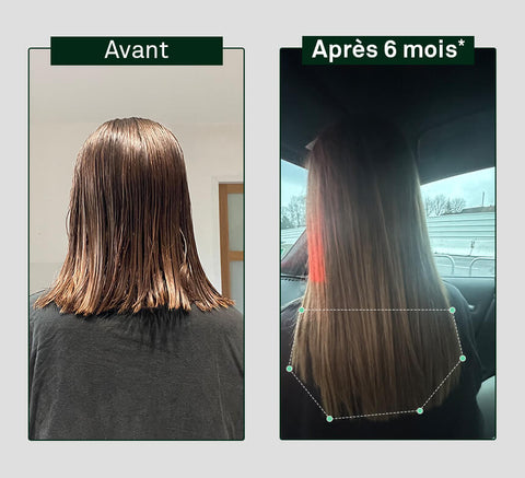 Pirms un pēc matu augšanas salīdzinājums uz personas galvas, parādot redzamu atšķirību pēc sešiem mēnešiem.